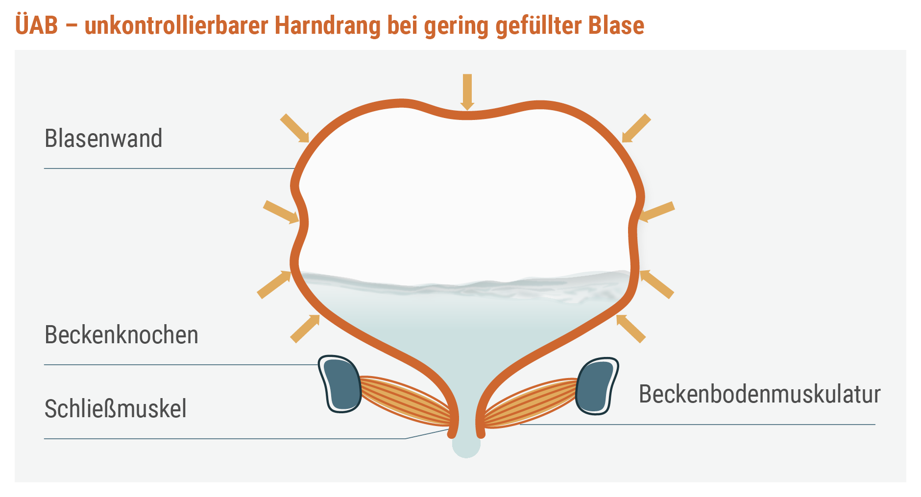 So-funktioniert-die-Blase