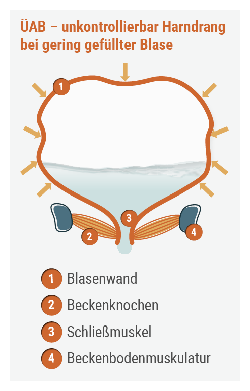 ast_blase-ok_Verstehen_So-funktioniert-die-Blase_3.png